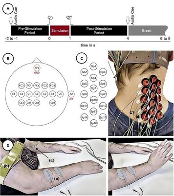 Measuring Spinal Cord Potentials and Cortico-Spinal Interactions After Wrist Movements Induced by Neuromuscular Electrical Stimulation